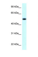 NAPRT Antibody - NAPRT1 antibody Western blot of Jurkat Cell lysate. Antibody concentration 1 ug/ml.  This image was taken for the unconjugated form of this product. Other forms have not been tested.