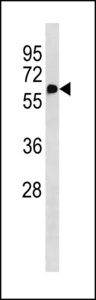 NAPRT Antibody - NAPRT1 Antibody western blot of HepG2 cell line lysates (35 ug/lane). The NAPRT1 antibody detected the NAPRT1 protein (arrow).
