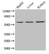 NAPRT Antibody - Western blot All lanes: NAPRT antibody at 4 µg/ml Lane 1: HepG2 whole cell lysate Lane 2: Mouse liver tissue Lane 3: Mouse kidney tissue Secondary Goat polyclonal to rabbit IgG at 1/10000 dilution Predicted band size: 58, 61, 57 kDa Observed band size: 57 kDa