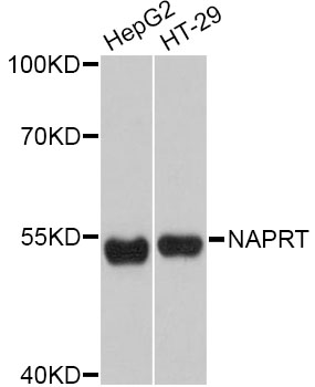 NAPRT Antibody - Western blot analysis of extracts of various cell lines, using NAPRT Antibody at 1:3000 dilution. The secondary antibody used was an HRP Goat Anti-Rabbit IgG (H+L) at 1:10000 dilution. Lysates were loaded 25ug per lane and 3% nonfat dry milk in TBST was used for blocking. An ECL Kit was used for detection and the exposure time was 30s.