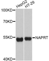 NAPRT Antibody - Western blot analysis of extracts of various cell lines, using NAPRT Antibody at 1:3000 dilution. The secondary antibody used was an HRP Goat Anti-Rabbit IgG (H+L) at 1:10000 dilution. Lysates were loaded 25ug per lane and 3% nonfat dry milk in TBST was used for blocking. An ECL Kit was used for detection and the exposure time was 30s.