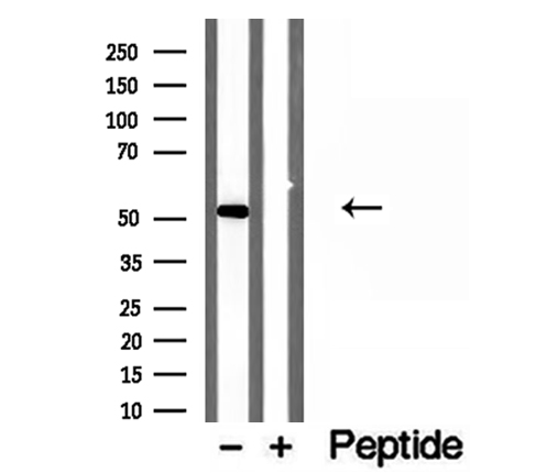NAPRT Antibody - Western blot analysis of extracts of HepG2 cells using NAPRT1 antibody.