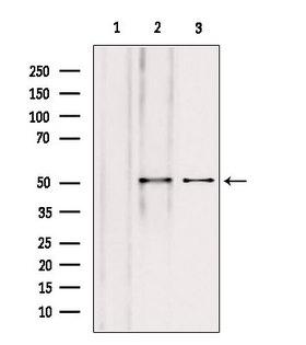 NAPRT Antibody - Western blot analysis of extracts of various samples using NAPRT1 antibody. Lane 1: HeLa treated with blocking peptide. Lane 2: HeLa; Lane 3: HepG2;