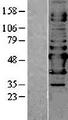 NAPRT Protein - Western validation with an anti-DDK antibody * L: Control HEK293 lysate R: Over-expression lysate