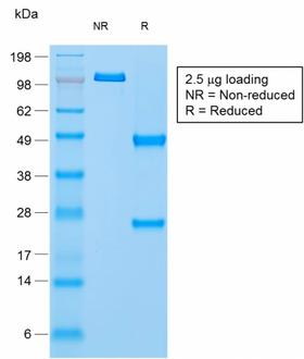 NAPSA / NAPA / Napsin A Antibody - SDS-PAGE Analysis PurifiedNapsinAMouse Monoclonal Antibody (rNAPSA/1239). Confirmation of Purity and Integrity of Antibody.