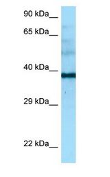 NAPSA / NAPA / Napsin A Antibody - NAPSA / NAPA / Napsin A antibody Western Blot of Placenta.  This image was taken for the unconjugated form of this product. Other forms have not been tested.