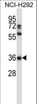 NAPSA / NAPA / Napsin A Antibody - NAPSA Antibody western blot of NCI-H292 cell line lysates (35 ug/lane). The NAPSA antibody detected the NAPSA protein (arrow).