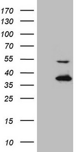 NAPSA / NAPA / Napsin A Antibody - HEK293T cells were transfected with the pCMV6-ENTRY control. (Left lane) or pCMV6-ENTRY NAPSA. (Right lane) cDNA for 48 hrs and lysed. Equivalent amounts of cell lysates. (5 ug per lane) were separated by SDS-PAGE and immunoblotted with anti-NAPSA. (1:2000)