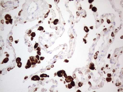 NAPSA / NAPA / Napsin A Antibody - Immunohistochemical staining of paraffin-embedded Human lung tissue within the normal limits using anti-NAPSA mouse monoclonal antibody. (Heat-induced epitope retrieval by 1mM EDTA in 10mM Tris buffer. (pH8.5) at 110°C for 10 min. (1:150)