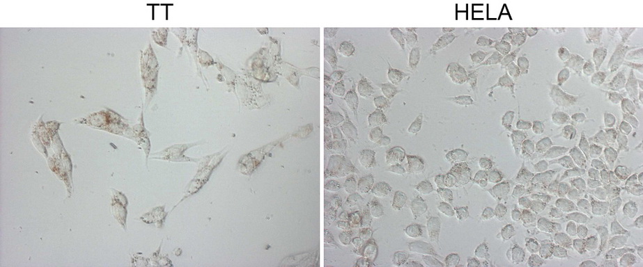 NAPSA / NAPA / Napsin A Antibody - Immunocytochemistry staining of TT cells using anti-NAPSA mouse monoclonal antibody. The right is HELA cells as negative control. (1:20000)