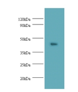 NAPSA / NAPA / Napsin A Antibody - [Character 8bf4]: Direct ELISA Protocol Indirect ELISA Protocol Sandwich ELISA Protocol Western Blotting Protocol.  This image was taken for the unconjugated form of this product. Other forms have not been tested.