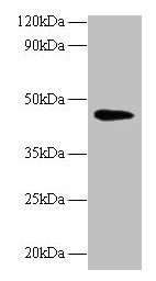NAPSA / NAPA / Napsin A Antibody - Western blot All lanes: Napsin-A antibody at 2µg/ml + Mouse kidney tissue Secondary Goat polyclonal to Ribbit lgG at 1/10000 dilution Predicted band size: 45 kDa Observed band size: 45 kDa