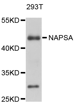 NAPSA / NAPA / Napsin A Antibody - Western blot analysis of extracts of 293T cells.