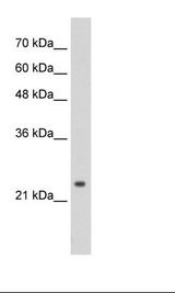 NAR / CPSF4 Antibody - Jurkat Cell Lysate.  This image was taken for the unconjugated form of this product. Other forms have not been tested.