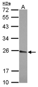 NAR / CPSF4 Antibody - Sample (30 ug of whole cell lysate) A: A431 12% SDS PAGE CPSF4 antibody diluted at 1:1000