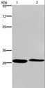 NAR / CPSF4 Antibody - Western blot analysis of HeLa and 293T cell, using CPSF4 Polyclonal Antibody at dilution of 1:400.