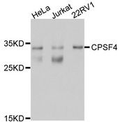 NAR / CPSF4 Antibody - Western blot analysis of extracts of various cell lines, using CPSF4 antibody at 1:1000 dilution. The secondary antibody used was an HRP Goat Anti-Rabbit IgG (H+L) at 1:10000 dilution. Lysates were loaded 25ug per lane and 3% nonfat dry milk in TBST was used for blocking. An ECL Kit was used for detection and the exposure time was 15s.