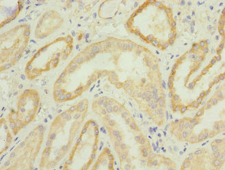 NAR / CPSF4 Antibody - Immunohistochemistry of paraffin-embedded human kidney tissue at dilution 1:100
