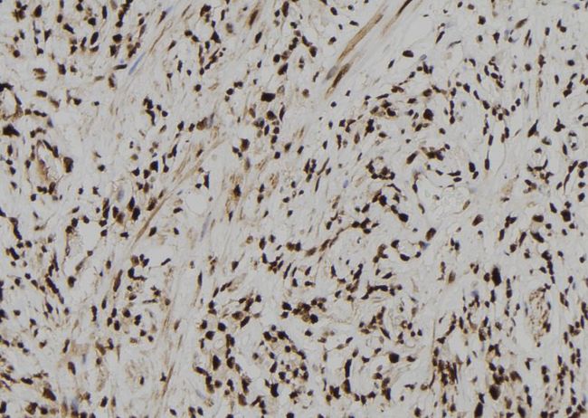 NAR / CPSF4 Antibody - 1:100 staining human gastric tissue by IHC-P. The sample was formaldehyde fixed and a heat mediated antigen retrieval step in citrate buffer was performed. The sample was then blocked and incubated with the antibody for 1.5 hours at 22°C. An HRP conjugated goat anti-rabbit antibody was used as the secondary.