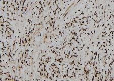 NAR / CPSF4 Antibody - 1:100 staining human gastric tissue by IHC-P. The sample was formaldehyde fixed and a heat mediated antigen retrieval step in citrate buffer was performed. The sample was then blocked and incubated with the antibody for 1.5 hours at 22°C. An HRP conjugated goat anti-rabbit antibody was used as the secondary.
