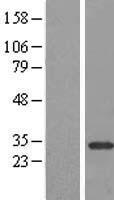 NAR / CPSF4 Protein - Western validation with an anti-DDK antibody * L: Control HEK293 lysate R: Over-expression lysate