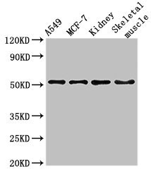 NARF Antibody - Western Blot Positive WB detected in:A549 whole cell lysate,MCF-7 whole cell lysate,Mouse kidney tissue,Mouse skeletal muscle tissue All Lanes:NARF antibody at 3µg/ml Secondary Goat polyclonal to rabbit IgG at 1/50000 dilution Predicted band size: 52,57,46,45 KDa Observed band size: 52 KDa