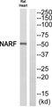 NARF Antibody - Western blot analysis of extracts from Rat Heart cells, using NARF antibody.