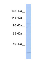 NARG1 / NAA15 Antibody - NAA15 / NARG1 antibody Western blot of Fetal Kidney lysate. This image was taken for the unconjugated form of this product. Other forms have not been tested.