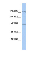 NARG1 / NAA15 Antibody - NAA15 / NARG1 antibody Western blot of THP-1 cell lysate. This image was taken for the unconjugated form of this product. Other forms have not been tested.