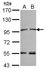 NARG1 / NAA15 Antibody - Sample (30 ug of whole cell lysate) A: NT2D1 B: IMR32 7.5% SDS PAGE NAA15 / NARG1 antibody diluted at 1:10000