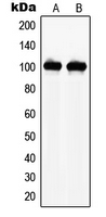 NARG1 / NAA15 Antibody - Western blot analysis of NAA15 expression in THP1 (A); HEK293 (B) whole cell lysates.