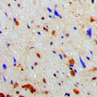NARG1 / NAA15 Antibody - Immunohistochemical analysis of NAA15 staining in human brain formalin fixed paraffin embedded tissue section. The section was pre-treated using heat mediated antigen retrieval with sodium citrate buffer (pH 6.0). The section was then incubated with the antibody at room temperature and detected using an HRP conjugated compact polymer system. DAB was used as the chromogen. The section was then counterstained with hematoxylin and mounted with DPX.