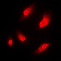 NARG1 / NAA15 Antibody - Immunofluorescent analysis of NAA15 staining in THP1 cells. Formalin-fixed cells were permeabilized with 0.1% Triton X-100 in TBS for 5-10 minutes and blocked with 3% BSA-PBS for 30 minutes at room temperature. Cells were probed with the primary antibody in 3% BSA-PBS and incubated overnight at 4 C in a humidified chamber. Cells were washed with PBST and incubated with a DyLight 594-conjugated secondary antibody (red) in PBS at room temperature in the dark. DAPI was used to stain the cell nuclei (blue).