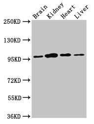 NARG1 / NAA15 Antibody - Positive Western Blot detected in Rat brain tissue, Rat kidney tissue, Mouse heart tissue, Mouse liver tissue. All lanes: NAA15 antibody at 3 µg/ml Secondary Goat polyclonal to rabbit IgG at 1/50000 dilution. Predicted band size: 102, 62 KDa. Observed band size: 95 KDa