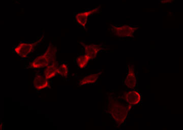 NARG1 / NAA15 Antibody - Staining HuvEc cells by IF/ICC. The samples were fixed with PFA and permeabilized in 0.1% Triton X-100, then blocked in 10% serum for 45 min at 25°C. The primary antibody was diluted at 1:200 and incubated with the sample for 1 hour at 37°C. An Alexa Fluor 594 conjugated goat anti-rabbit IgG (H+L) Ab, diluted at 1/600, was used as the secondary antibody.