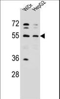 NARS Antibody - NARS Antibody western blot of WiDr,HepG2 cell line lysates (35 ug/lane). The NARS antibody detected the NARS protein (arrow).