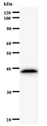 NARS Antibody - Western blot of immunized recombinant protein using NARS antibody.
