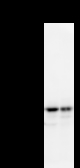 NARS Antibody - Detection of NARS by Western blot. Samples: Whole cell lysate from human HT1080 (H, 25 ug) and mouse NIH3T3 (M, 25 ug) cells. Predicted molecular weight: 62 kDa