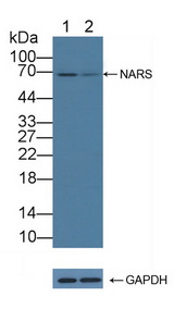 NARS Antibody - Knockout Varification: Lane 1: Wild-type K562 cell lysate; Lane 2: NARS knockout K562 cell lysate; Predicted MW: 20,63kd Observed MW: 65kd Primary Ab: 1µg/ml Rabbit Anti-Human NARS Antibody Second Ab: 0.2µg/mL HRP-Linked Caprine Anti-Rabbit IgG Polyclonal Antibody