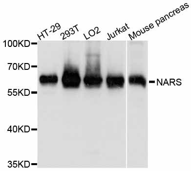 NARS Antibody - Western blot analysis of extracts of various cell lines, using NARS antibody at 1:1000 dilution. The secondary antibody used was an HRP Goat Anti-Rabbit IgG (H+L) at 1:10000 dilution. Lysates were loaded 25ug per lane and 3% nonfat dry milk in TBST was used for blocking. An ECL Kit was used for detection and the exposure time was 3s.