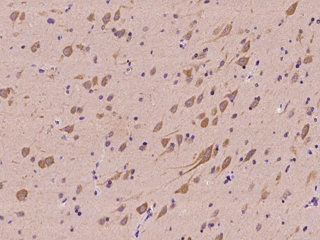 NARS Antibody - Immunochemical staining of human NARS in human brain with rabbit polyclonal antibody at 1:500 dilution, formalin-fixed paraffin embedded sections.