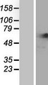 NARS Protein - Western validation with an anti-DDK antibody * L: Control HEK293 lysate R: Over-expression lysate