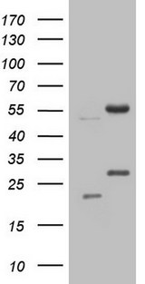 NARS2 Antibody - HEK293T cells were transfected with the pCMV6-ENTRY control (Left lane) or pCMV6-ENTRY NARS2 (Right lane) cDNA for 48 hrs and lysed. Equivalent amounts of cell lysates (5 ug per lane) were separated by SDS-PAGE and immunoblotted with anti-NARS2.