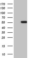 NARS2 Antibody - HEK293T cells were transfected with the pCMV6-ENTRY control. (Left lane) or pCMV6-ENTRY NARS2. (Right lane) cDNA for 48 hrs and lysed. Equivalent amounts of cell lysates. (5 ug per lane) were separated by SDS-PAGE and immunoblotted with anti-NARS2.