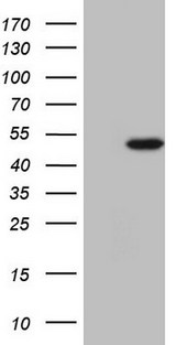 NARS2 Antibody - HEK293T cells were transfected with the pCMV6-ENTRY control. (Left lane) or pCMV6-ENTRY NARS2. (Right lane) cDNA for 48 hrs and lysed. Equivalent amounts of cell lysates. (5 ug per lane) were separated by SDS-PAGE and immunoblotted with anti-NARS2.