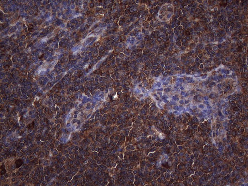 NARS2 Antibody - Immunohistochemical staining of paraffin-embedded Human tonsil within the normal limits using anti-NARS2 mouse monoclonal antibody. (Heat-induced epitope retrieval by 1mM EDTA in 10mM Tris buffer. (pH8.5) at 120°C for 3 min. (1:150)