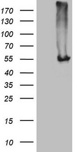NARS2 Antibody - HEK293T cells were transfected with the pCMV6-ENTRY control. (Left lane) or pCMV6-ENTRY NARS2. (Right lane) cDNA for 48 hrs and lysed