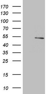 NARS2 Antibody - HEK293T cells were transfected with the pCMV6-ENTRY control. (Left lane) or pCMV6-ENTRY NARS2. (Right lane) cDNA for 48 hrs and lysed. Equivalent amounts of cell lysates. (5 ug per lane) were separated by SDS-PAGE and immunoblotted with anti-NARS2. (1:500)