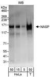 NASP Antibody - Detection of Human NASP by Western Blot. Samples: Whole cell lysate from HeLa (5, 15 and 50 ug) and 293T (T; 50 ug) cells. Antibody: Affinity purified rabbit anti-NASP antibody used for WB at 0.04 ug/ml. Detection: Chemiluminescence with an exposure time of 10 seconds.