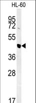 NASP Antibody - Western blot of NASP Antibody ) in HL-60 cell line lysates (35 ug/lane). NASP (arrow) was detected using the purified antibody.